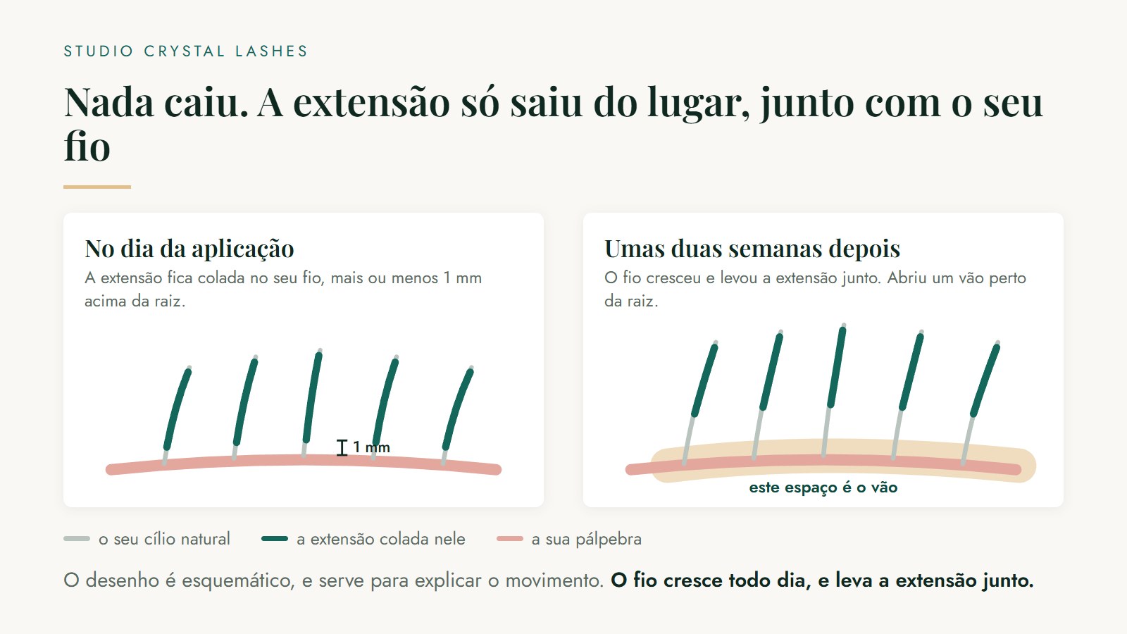 Desenho comparando o olho no dia da aplicação, com a extensão colada um milímetro acima da raiz, e duas semanas depois, com o fio crescido e um vão aberto perto da pálpebra