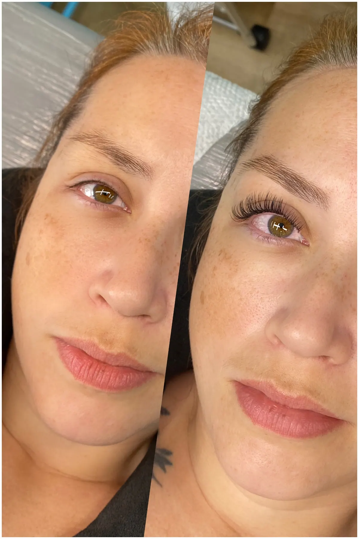Resultado antes e depois da extensão fio a fio clássico